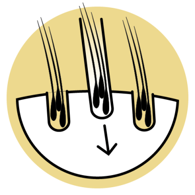 MALECOR_DHI-Methode-Hair