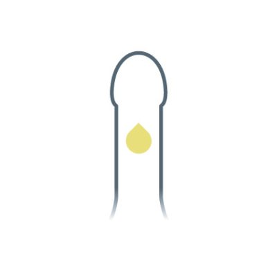 MALECOR_Ejakulationsstörung-hell_intim