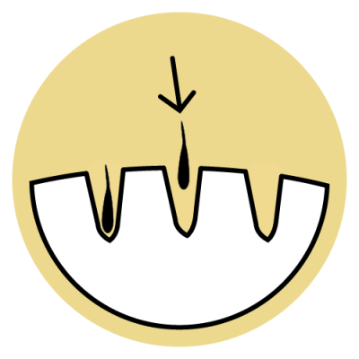 MALECOR_FUE-Methode-Hair