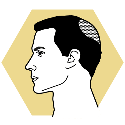 MALECOR-Hair_Tonsur_icon