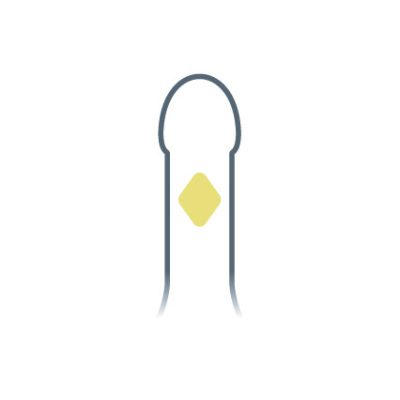 MALECOR_Viagra-hell_intim